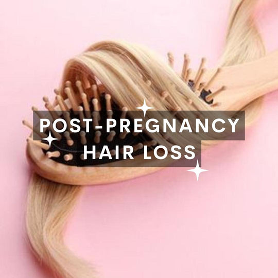 Post-Pregnancy Hair Loss